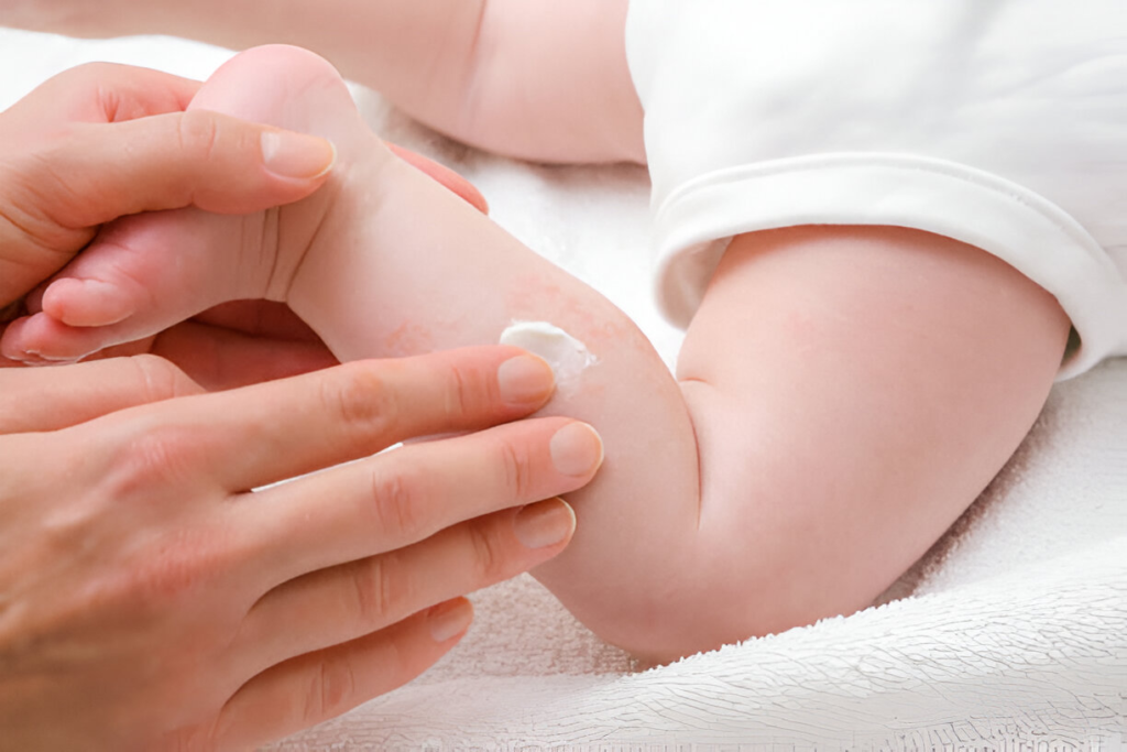 Tips for Preventing and Treating Baby Chafing